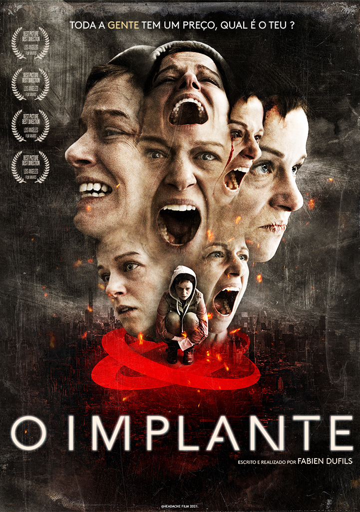 Capa O Implante