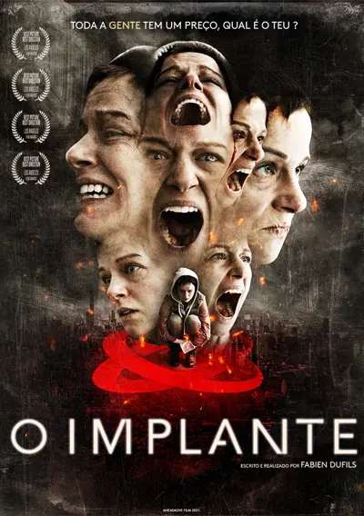 Capa O Implante